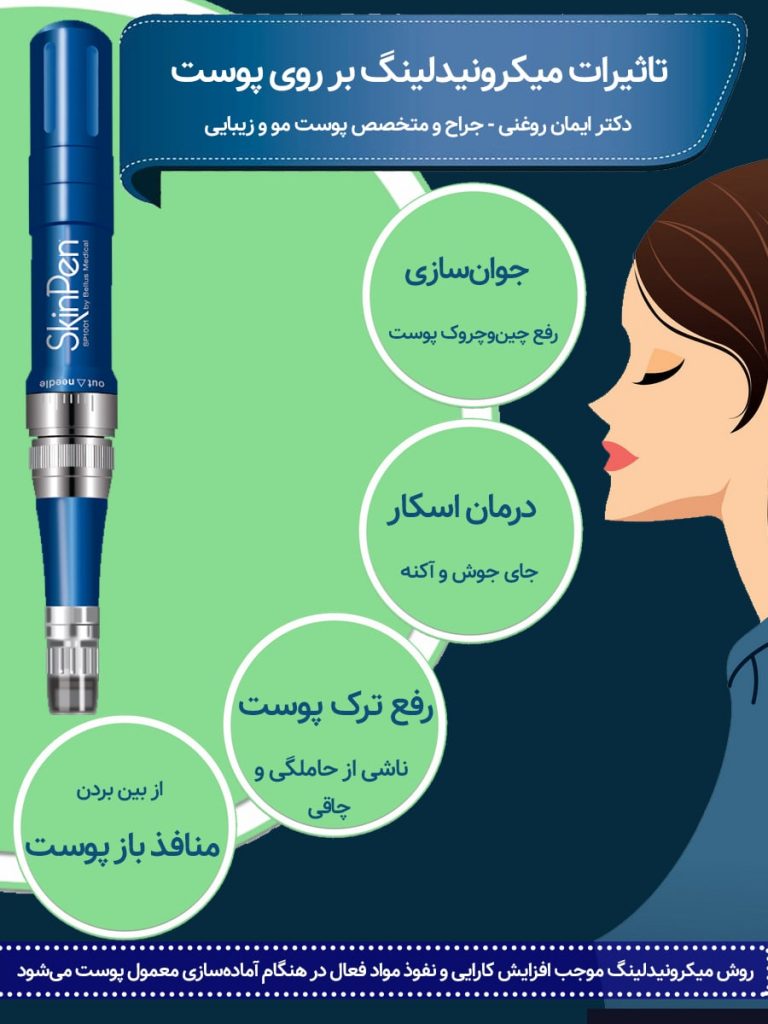 اینفوگرافی میکرونیدلینگ پوست