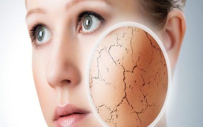 انواع بیماری های پوستی را بشناسید
