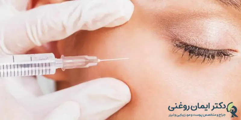 مراقبت_های بعد از تزریق ژل زیر چشم مراقبت_های بعد از تزریق ژل زیر چشم