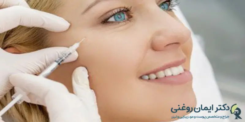 مراقبت_ های بعد از تزریق ژل زیر چشم مراقبت_ های بعد از تزریق ژل زیر چشم