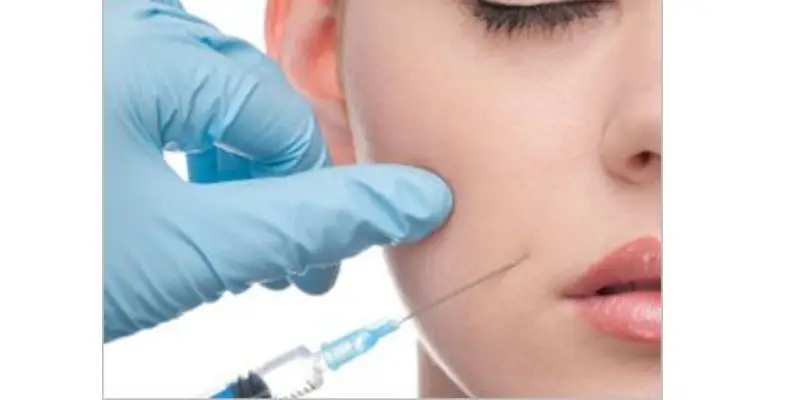 مراقبت_ بعد از فیلر خط خنده مراقبت_ بعد از فیلر خط خنده