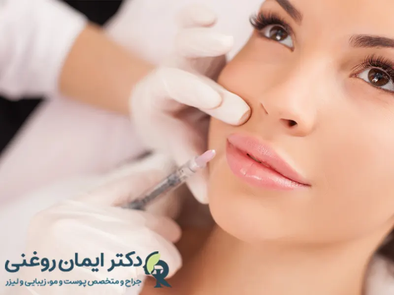 هزینه فیلر خط خنده